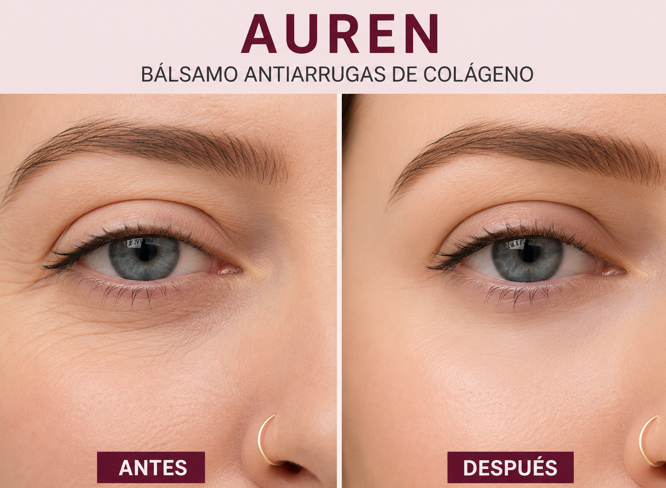 Contorno de ojos — 4 semanas de uso